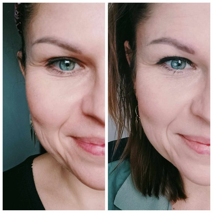 Agnieszka - efekt przed i po stosowaniu WOW KOLAGEN, widoczne spłycenie zmarszczek mimicznych